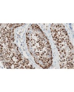 Sigma-Aldrich Anti-Rest Antibody, Clone