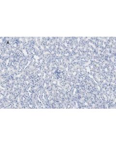 Sigma-Aldrich Anti-Calbindin D-28k Cl1a1