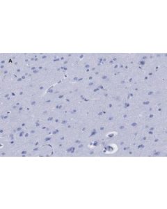 Sigma-Aldrich Anti-Gfap, Clone 2e8, Zoom